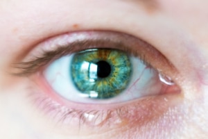 iperlacrimazione - CAMO - Centro Ambrosiano Oftalmico