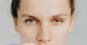 oculoplastica prima e dopo - CAMO - Centro Ambrosiano Oftalmico