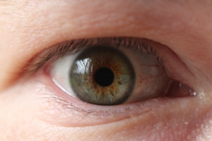 blefarocalasi - blefaroplastica - CAMO - Centro Ambrosiano Oftalmico